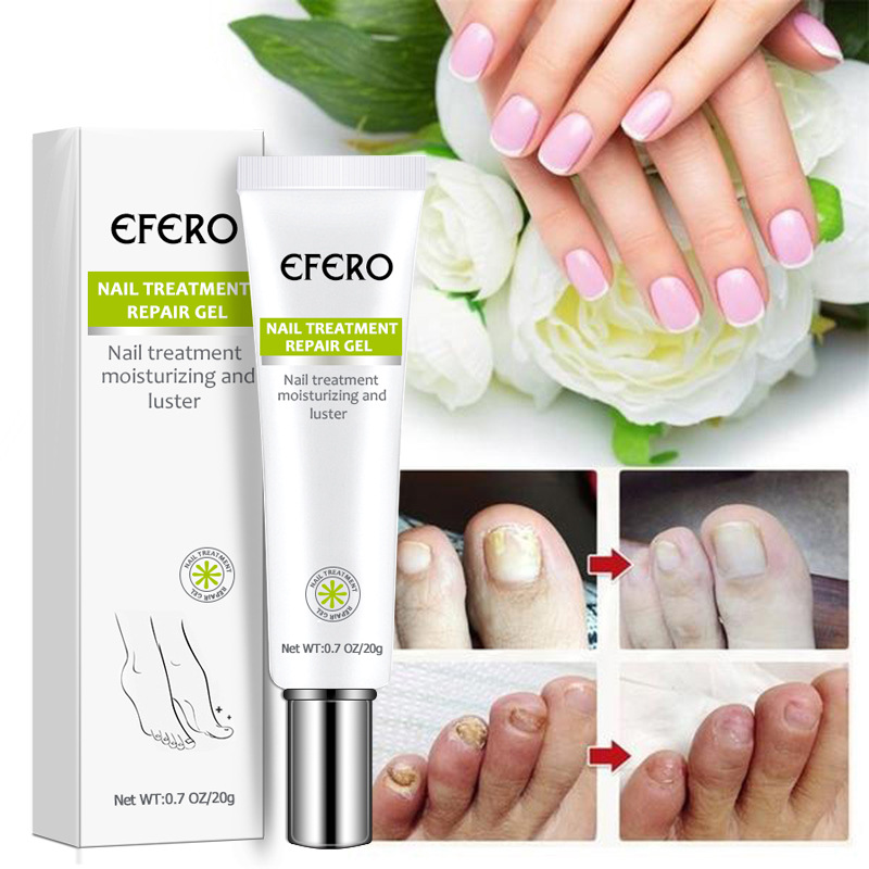 Nail Treatment Repair Gel