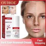 Dark Spot Remover Cream